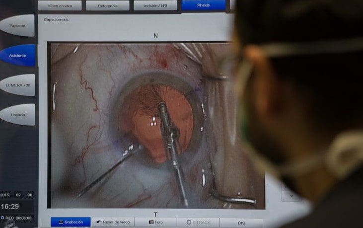Luis Manuel Barreiro Blanco medical image of eye